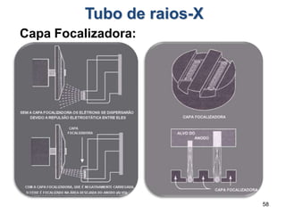 58
Tubo de raios-X
Capa Focalizadora:
 