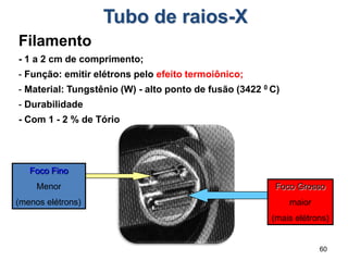60
Tubo de raios-X
Filamento
- 1 a 2 cm de comprimento;
- Função: emitir elétrons pelo efeito termoiônico;
- Material: Tungstênio (W) - alto ponto de fusão (3422 0 C)
- Durabilidade
- Com 1 - 2 % de Tório
Foco Fino
Menor
(menos elétrons)
Foco Grosso
maior
(mais elétrons)
 