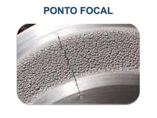 PONTO FOCAL
 