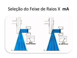Seleção do Feixe de Raios X mA
 