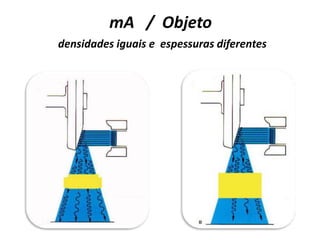 mA / Objeto
densidades iguais e espessuras diferentes
 