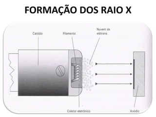 FORMAÇÃO DOS RAIO X
 