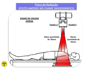 Física da Radiação
EFEITO ANÓDIO NO EXAME RADIOGRÁFICO
Catodo (-) Anodo(+)
Menor
quantidade de
fótons
Maior quantidade
de fótons
EXAME DA COLUNA
DORSAL
 