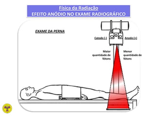 Catodo (-) Anodo (+)
Menor
quantidade de
fótons
Maior
quantidade de
fótons
EXAME DA PERNA
Física da Radiação
EFEITO ANÓDIO NO EXAME RADIOGRÁFICO
 