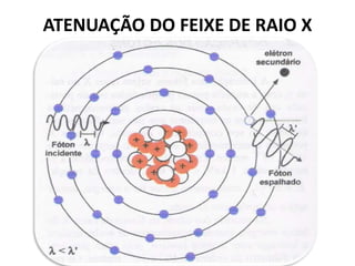 ATENUAÇÃO DO FEIXE DE RAIO X
EFEITO COMPTON
 