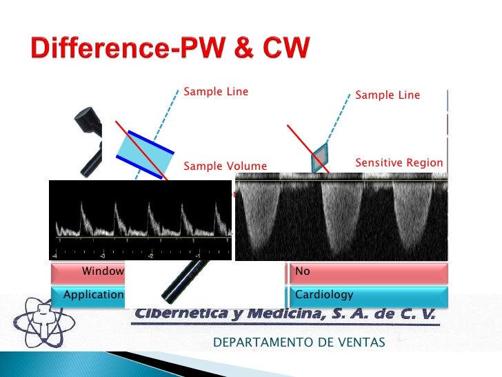 Física básica del ultrasonido