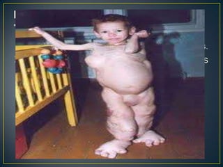 • A descoberta das radiações ionizantes e dos
compostos dotados de radioatividade natural
logo interessou à biologia e às ciências médicas.
Pelos danos que causavam nas estruturas
vivas
 