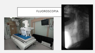 FLUOROSCOPIA
 