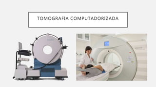 TOMOGRAFIA COMPUTADORIZADA
 
