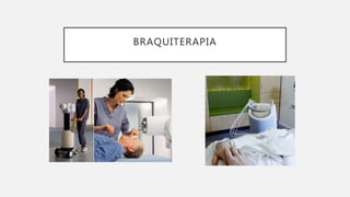 BRAQUITERAPIA
 