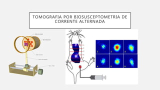 TOMOGRAFIA POR BIOSUSCEPTOMETRIA DE
CORRENTE ALTERNADA
 
