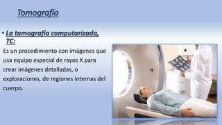 Tomografía
• La tomografía computarizada,
TC:
Es un procedimiento con imágenes que
usa equipo especial de rayos X para
crear imágenes detalladas, o
exploraciones, de regiones internas del
cuerpo.
 