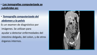 • Tomografía computarizada del
abdomen y la pelvis
Es un examen de diagnóstico por
imágenes. Se utilizan para
ayudar a detectar enfermedades del
intestino delgado, del colon, y de otros
órganos internos.
• Las tomografías computarizada se
subdividen en:
 