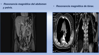 • Resonancia magnética del abdomen
y pelvis.
• Resonancia magnética de tórax.
 