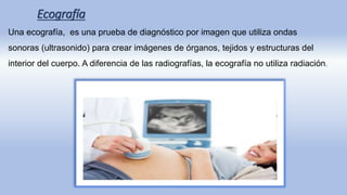 Ecografía
Una ecografía, es una prueba de diagnóstico por imagen que utiliza ondas
sonoras (ultrasonido) para crear imágenes de órganos, tejidos y estructuras del
interior del cuerpo. A diferencia de las radiografías, la ecografía no utiliza radiación.
 