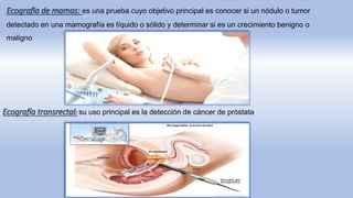 Ecografía de mamas: es una prueba cuyo objetivo principal es conocer si un nódulo o tumor
detectado en una mamografía es líquido o sólido y determinar si es un crecimiento benigno o
maligno
Ecografía transrectal: su uso principal es la detección de cáncer de próstata
 