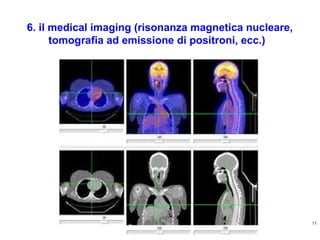 6. il medical imaging (risonanza magnetica nucleare,
tomografia ad emissione di positroni, ecc.)

11
http://ricercatorialberi.blogspot.com

 