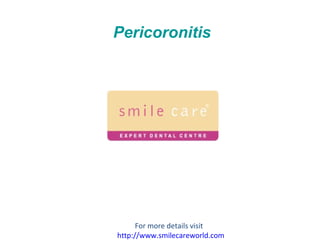 Pericoronitis For more details visit  http://www.smilecareworld.com 