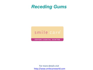 Receding Gums For more details visit  http://www.smilecareworld.com 