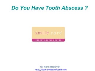 Do You Have Tooth Abscess ? For more details visit  http://www.smilecareworld.com 