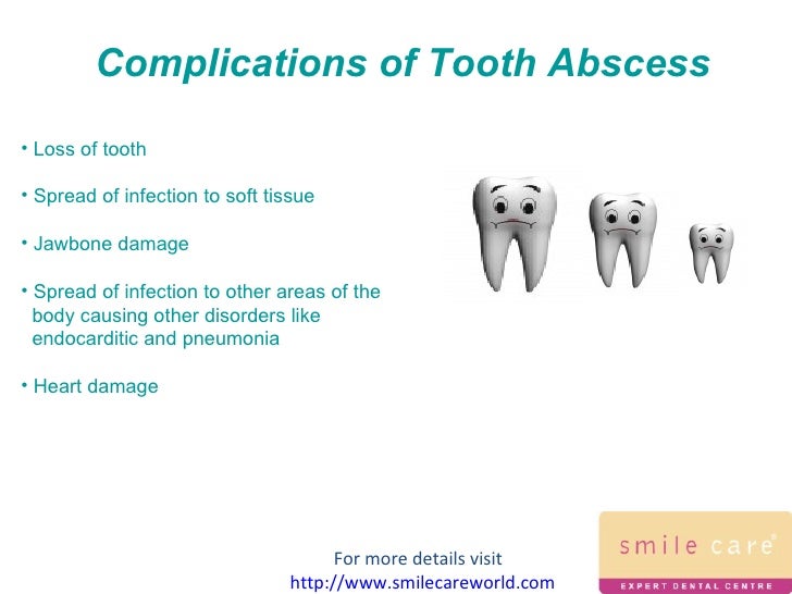 abscess