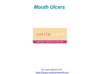 Mouth Ulcers For more details visit  http://www.smilecareworld.com 