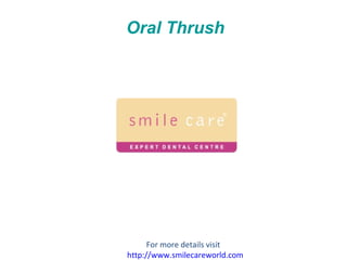 Oral Thrush For more details visit  http://www.smilecareworld.com 