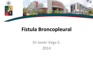 Fístula	
  Broncopleural	
  
Dr	
  Javier	
  Vega	
  S.	
  
2014	
  
 