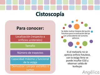 Para conocer: 
Localización (respecto a 
orificios ureterales) 
Tamaño 
Número de trayectos 
Capacidad máxima y funcional 
de la vejiga 
Demostrar cuerpos extraños o 
tumor 
Cistoscopía 
Se debe realizar biopsia del punto 
fistuloso para la evaluación del px 
con antecedente de tumores 
Angélica 
pélvicos 
Si al realizarla no se 
aprecia orificio fistuloso, 
con la vejiga llena se 
puede insuflar CO2 y 
observar salida de 
burbujas 
 