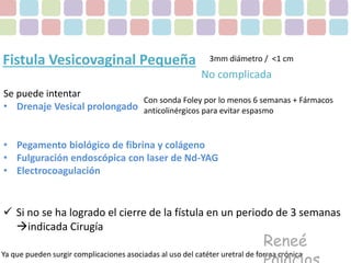 Fistula Vesicovaginal Pequeña 
Se puede intentar 
• Drenaje Vesical prolongado 
3mm diámetro / <1 cm 
No complicada 
Con sonda Foley por lo menos 6 semanas + Fármacos 
anticolinérgicos para evitar espasmo 
• Pegamento biológico de fibrina y colágeno 
• Fulguración endoscópica con laser de Nd-YAG 
• Electrocoagulación 
 Si no se ha logrado el cierre de la fístula en un periodo de 3 semanas 
indicada Cirugía 
Reneé 
Palacios 
Ya que pueden surgir complicaciones asociadas al uso del catéter uretral de forma crónica 
 