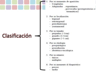 Clasificación 
 