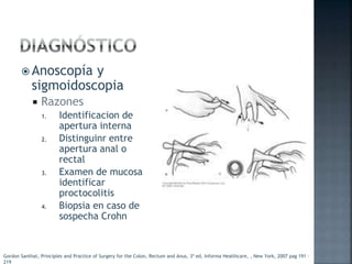  Anoscopía y
sigmoidoscopia
 Razones
1. Identificacion de
apertura interna
2. Distinguinr entre
apertura anal o
rectal
3. Examen de mucosa
identificar
proctocolitis
4. Biopsia en caso de
sospecha Crohn
Gordon Santhat, Principles and Practice of Surgery for the Colon, Rectum and Anus, 3ª ed, Informa Healthcare, , New York, 2007 pag 191 -
219
 