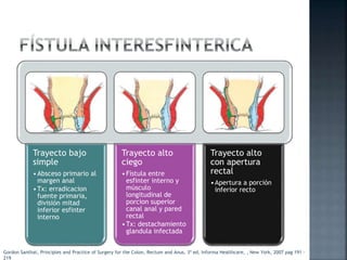 Trayecto bajo
simple
•Absceso primario al
margen anal
•Tx: erradicacion
fuente primaria,
división mitad
inferior esfinter
interno
Trayecto alto
ciego
•Fístula entre
esfinter interno y
músculo
longitudinal de
porcion superior
canal anal y pared
rectal
•Tx: destachamiento
glandula infectada
Trayecto alto
con apertura
rectal
•Apertura a porción
inferior recto
Gordon Santhat, Principles and Practice of Surgery for the Colon, Rectum and Anus, 3ª ed, Informa Healthcare, , New York, 2007 pag 191 -
219
 