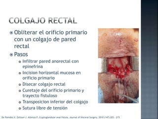  Obliterar el orificio primario
con un colgajo de pared
rectal
 Pasos
 Infiltrar pared anorectal con
epinefrina
 Incision horizontal mucosa en
orificio primario
 Disecar colgajo rectal
 Curetaje del orificio primario y
trayecto fistuloso
 Transposicion inferior del colgajo
 Sutura libre de tensión
De Paredes V. Zeltoun J. Atlenza P. Cryptoglandular anal fistula, Journal of Visceral Surgery, 2010 (147) 203 - 215
 