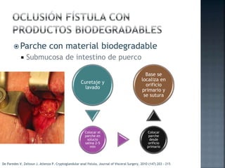  Parche con material biodegradable
 Submucosa de intestino de puerco
Curetaje y
lavado
Colocar el
parche en
solucio
salina 2-5
min
Colocar
parche
desde
orificio
primario
Base se
localiza en
orificio
primario y
se sutura
De Paredes V. Zeltoun J. Atlenza P. Cryptoglandular anal fistula, Journal of Visceral Surgery, 2010 (147) 203 - 215
 