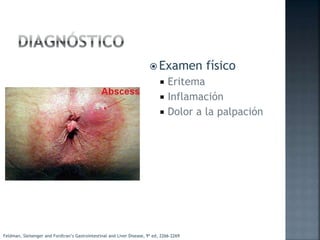  Examen físico
 Eritema
 Inflamación
 Dolor a la palpación
Feldman, Sleisenger and Fordtran’s Gastrointestinal and Liver Disease, 9ª ed, 2266-2269
 
