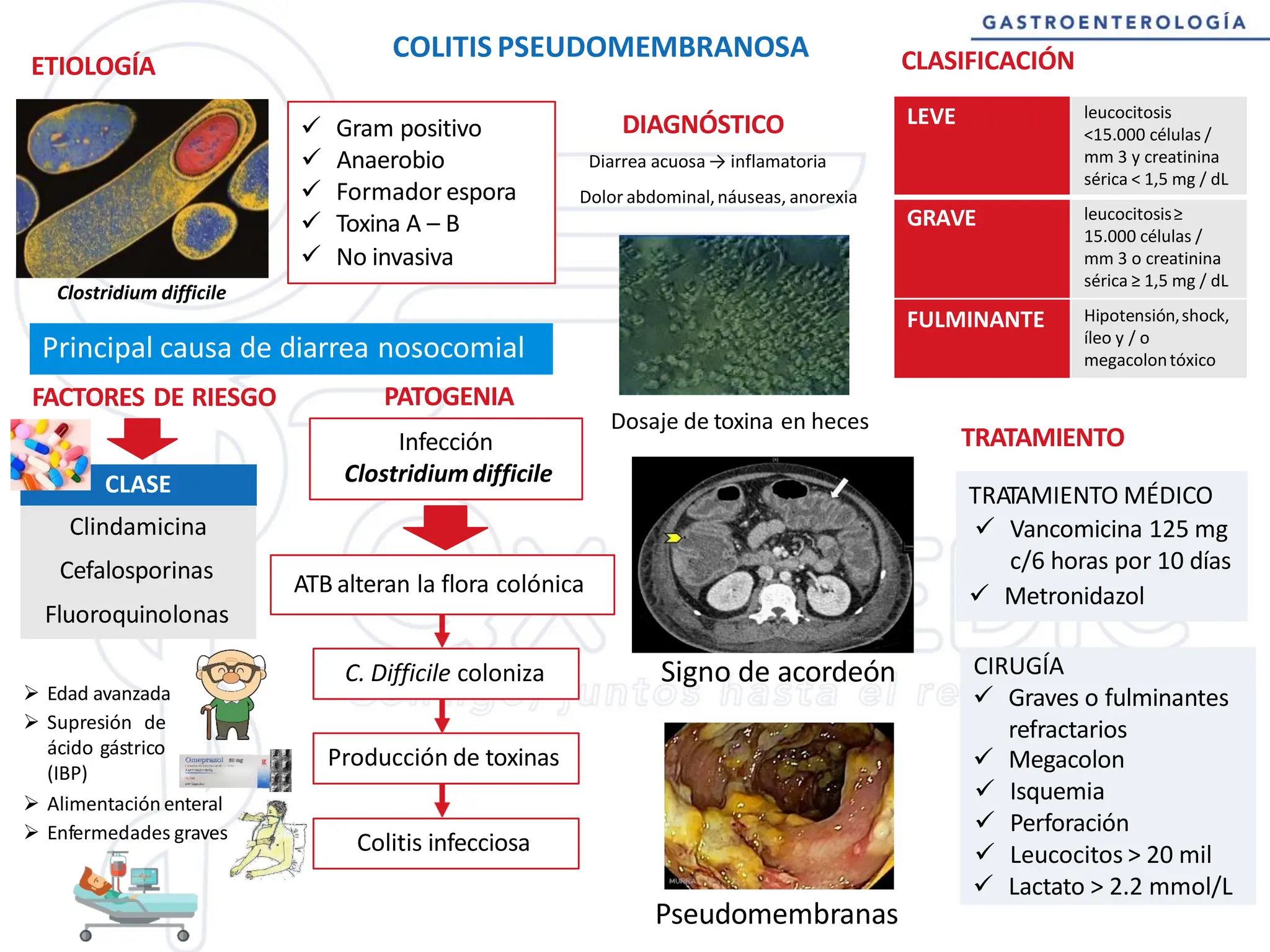 FT - GASTROENTEROLOGÍA - 3. Diarrea crónica - Colitis pseudomembranosa.pdf