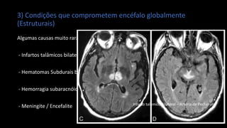 3) Condições que comprometem encéfalo globalmente
(Estruturais)
Algumas causas muito raras:
- Infartos talâmicos bilaterais
- Hematomas Subdurais bilaterais
- Hemorragia subaracnóidea
- Meningite / Encefalite Infarto talâmico Bilateral – Artéria de Pecheron
 