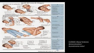 Copyrights apply
CUIDADO: Afasia/ Síndrome
demencial prévia /
Acometimento motor!
 