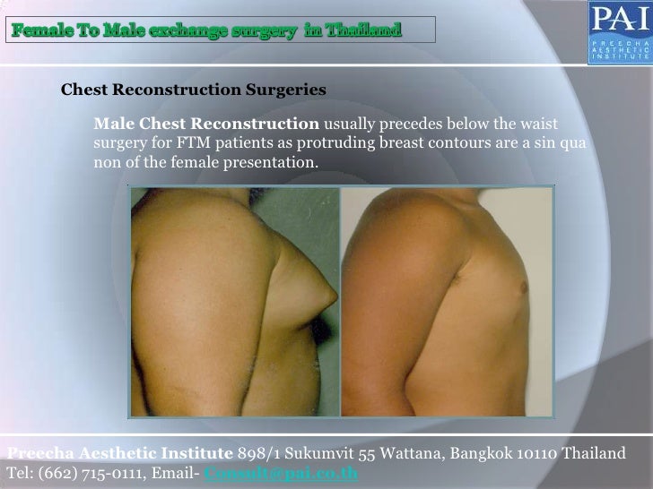 big-dick-surgery
