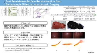 なかの
Fast Semi-dense Surface Reconstruction from
Stereoscopic Video in Laparoscopic Surgery3
どんなもの
⼿手法の流流れ
次に読むべき論論⽂文は？
腹腔内⼿手術の際にステレオビデオから⾼高速に物体の
三次元再構成を⾏行行う研究．
Evaluation of stereo matching costs on images with radiometric differences
[Hirschmueller, H., Scharstein, D / PAMI2008]
スコープカメラから画像取得，GPUで演算する．
視差を算出し，フィルタにかける．距離離に変換．
点群を再びフィルタにかけて三次元再構成．
 