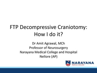 FTP Decompressive Craniotomy:
How I do it?
Dr Amit Agrawal, MCh
Professor of Neurosurgery
Narayana Medical College and Hospital
Nellore (AP)
 