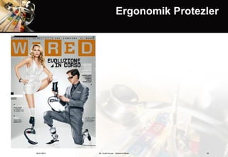 Ergonomik Protezler




19.01.2013   Dr. Cenk Tezcan Fütürizm Okulu   33
 