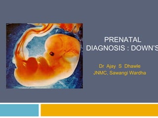 PRENATAL
DIAGNOSIS : DOWN’S

   Dr Ajay S Dhawle
 JNMC, Sawangi Wardha
 