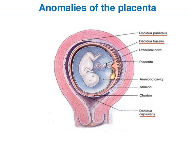 gestational trophoblastic disease