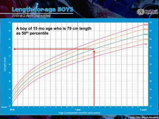 A boy of 15 mo age who is 79 cm length
as 50th percentile
 