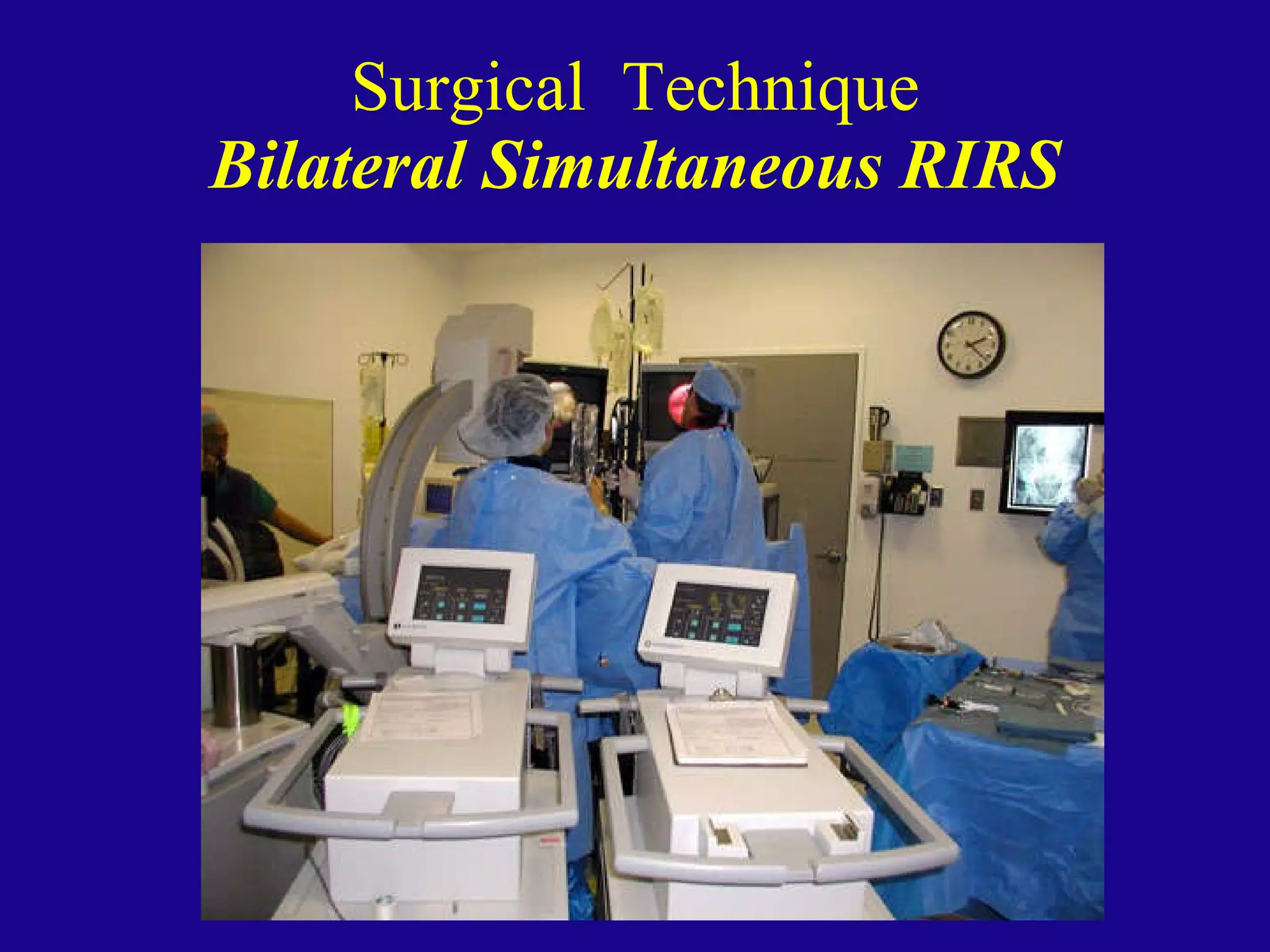 Rir R Iv Rim Retrograde Intrarenal Ureteroscopic Surgery (RIRS) | PPT