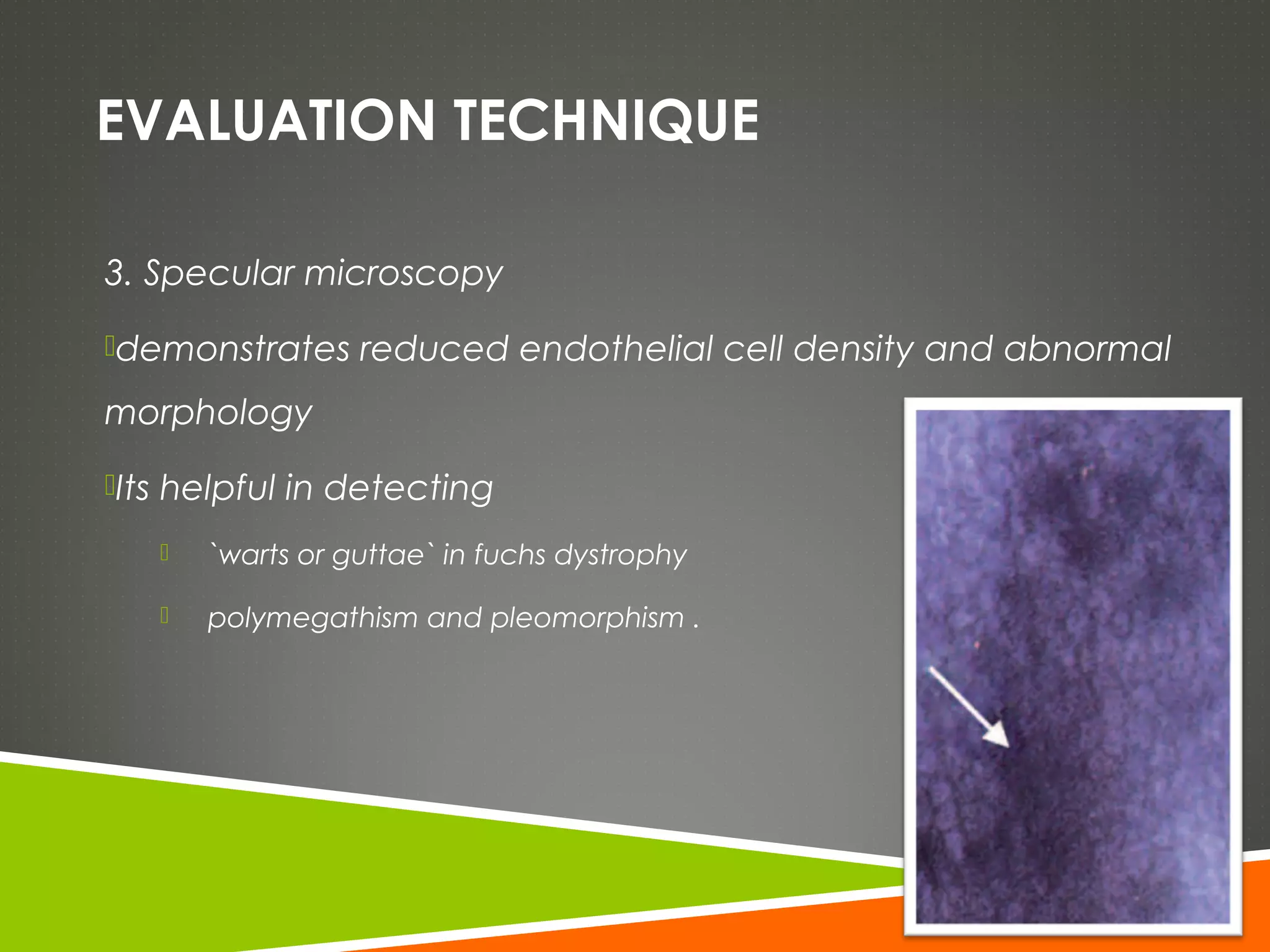Fuchs Technique Fuchs dystrophy and pseudophakic bullous keratopathy | PPT