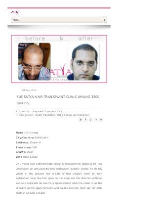 FUE SATYA HAIR TRANSPLANT CLINIC UMANG 3500
GRAFTS
Posted By : Satya Hair Transplant Clinic
Categorized : Beard Transplant , FUE-Follicular unit extraction
08 Sep 2012
Name: Dr. Umang
City/Country: Delhi/ India
Baldness: Grade VI
T reatment: FUE
Grafts: 3500
Date: 8.Sep.2012
Dr. Umang, was suffering from grade 6 Androgenetic alopecia. He had
undergone an unsuccessful hair restoration surgery earlier. As clearly
visible in the pictures the results of that surgery were far from
satisfaction. Very few hair grew on the scalp and the direction of those
was also wayward. He was very apprehensive when he came to us. But
at Satya all the apprehensions and doubts turn into faith. We did 3500
grafts in a single session.
Menu
 