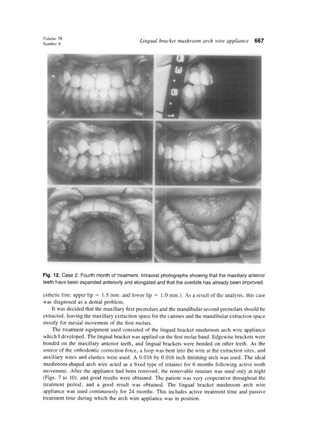 Fujita lingual orthodontics ajo article